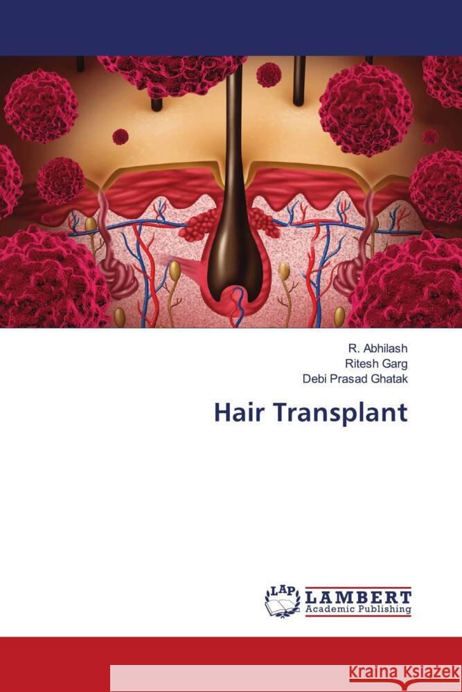 Hair Transplant Abhilash, R., Garg, Ritesh, Ghatak, Debi Prasad 9786207448777 LAP Lambert Academic Publishing