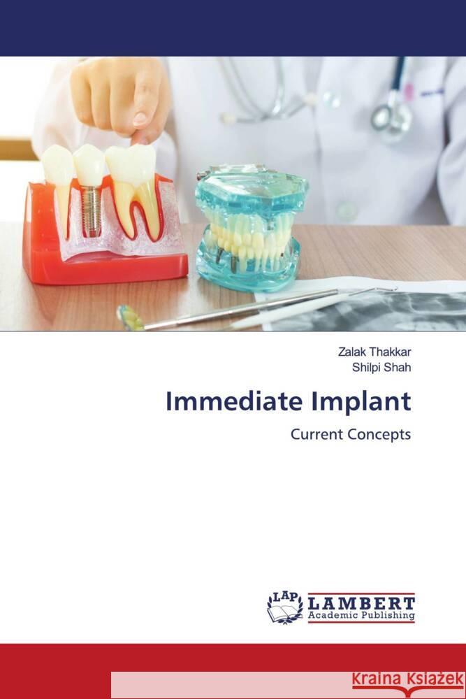 Immediate Implant Thakkar, Zalak, Shah, Shilpi 9786207449002