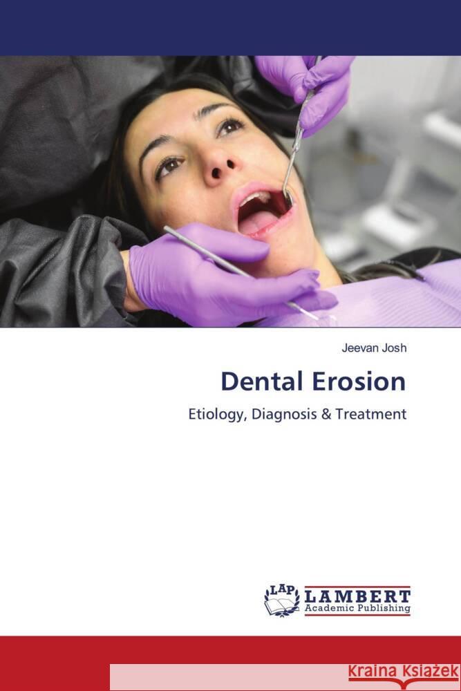 Dental Erosion Jeevan Josh 9786207451784