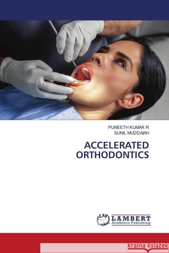 ACCELERATED ORTHODONTICS KUMAR R, PUNEETH, Muddaiah, Sunil 9786207456697 LAP Lambert Academic Publishing