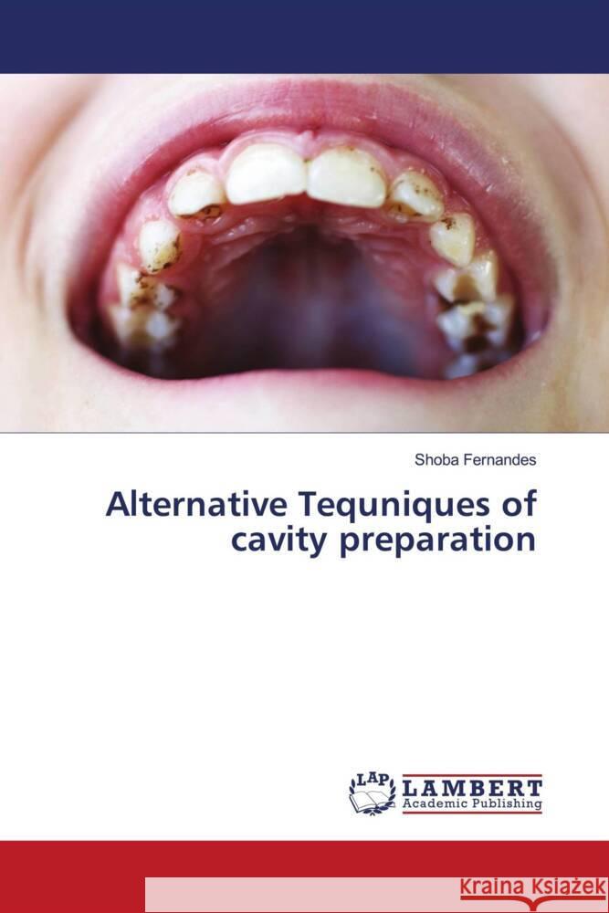 Alternative Tequniques of cavity preparation Shoba Fernandes 9786207459117
