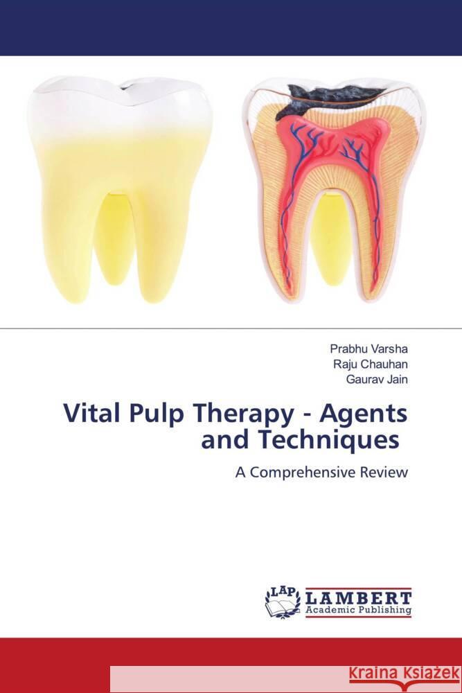 Vital Pulp Therapy - Agents and Techniques Varsha, Prabhu, Chauhan, Raju, Jain, Gaurav 9786207459506