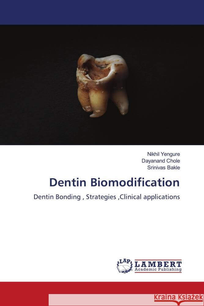 Dentin Biomodification Nikhil Yengure Dayanand Chole Srinivas Bakle 9786207460373