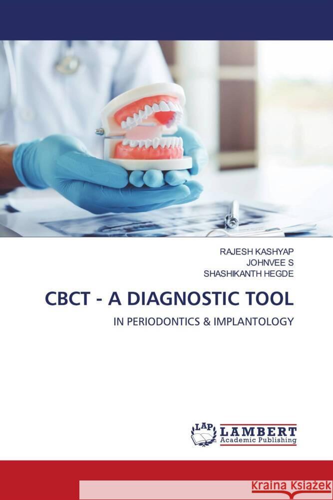 Cbct - A Diagnostic Tool Rajesh Kashyap Johnvee S Shashikanth Hegde 9786207462483