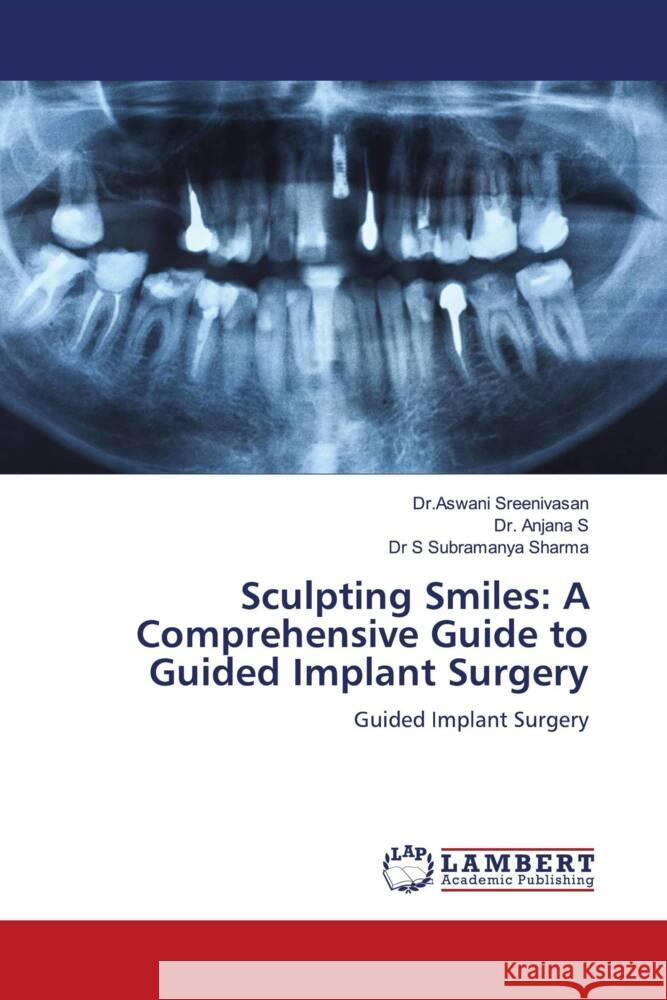 Sculpting Smiles: A Comprehensive Guide to Guided Implant Surgery Dr Aswani Sreenivasan Anjana S S. Subramanya Sharma 9786207466979