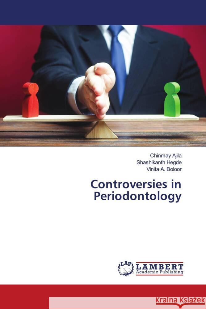 Controversies in Periodontology Chinmay Ajila Shashikanth Hegde Vinita A. Boloor 9786207469420