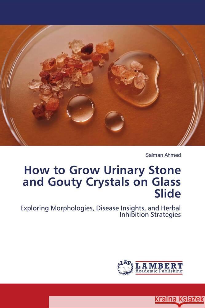 How to Grow Urinary Stone and Gouty Crystals on Glass Slide Salman Ahmed 9786207470334