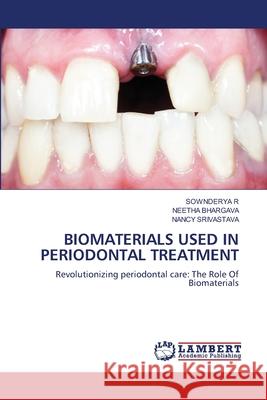 Biomaterials Used in Periodontal Treatment Sownderya R Neetha Bhargava Nancy Srivastava 9786207470822