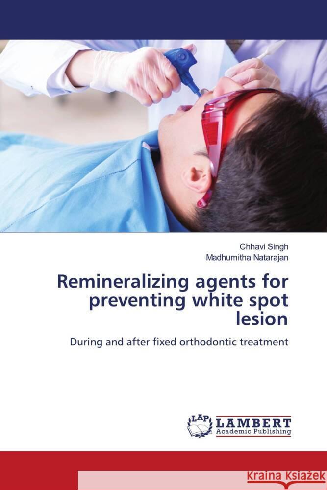 Remineralizing agents for preventing white spot lesion Chhavi Singh Madhumitha Natarajan 9786207471317