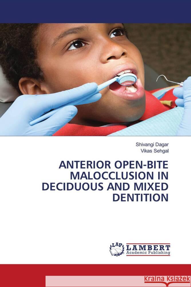Anterior Open-Bite Malocclusion in Deciduous and Mixed Dentition Shivangi Dagar Vikas Sehgal 9786207472598 LAP Lambert Academic Publishing