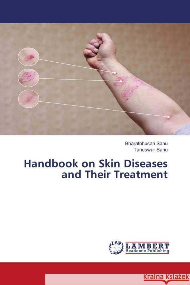 Handbook on Skin Diseases and Their Treatment Bharatbhusan Sahu Taneswar Sahu 9786207473540