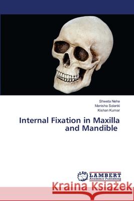 Internal Fixation in Maxilla and Mandible Nehe, Shweta, Solanki, Manisha, Kumar, Kishan 9786207473908