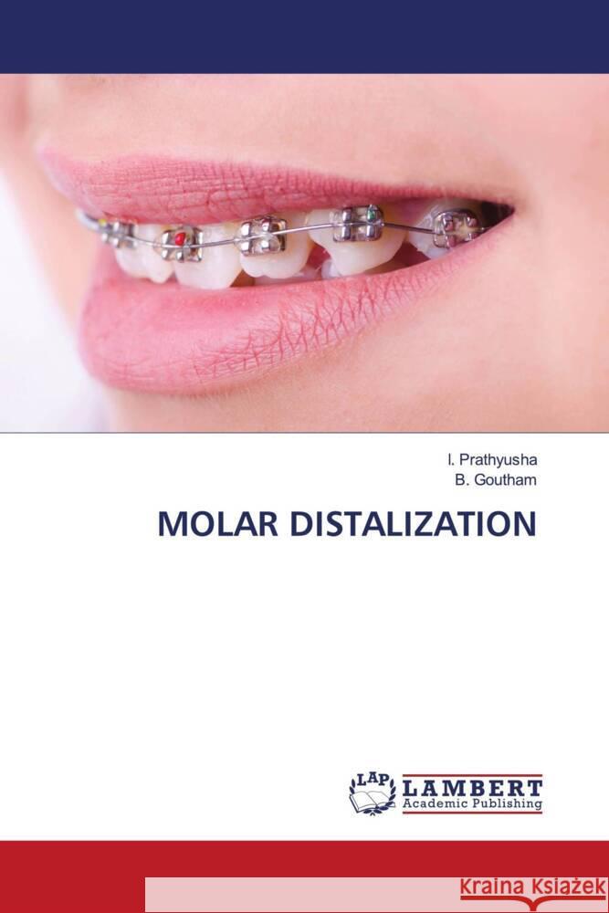 Molar Distalization I. Prathyusha B. Goutham 9786207475575 LAP Lambert Academic Publishing