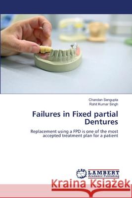 Failures in Fixed partial Dentures Chandan SenGupta Rohit Kumar Singh 9786207477500