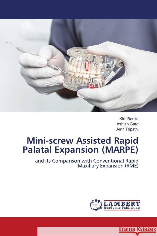 Mini-screw Assisted Rapid Palatal Expansion (MARPE) Kirti Banka Ashish Garg Amit Tripathi 9786207477852 LAP Lambert Academic Publishing