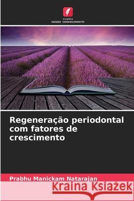 Regeneração periodontal com fatores de crescimento Manickam Natarajan, Prabhu 9786207481620