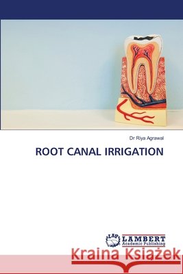Root Canal Irrigation Riya Agrawal 9786207483402