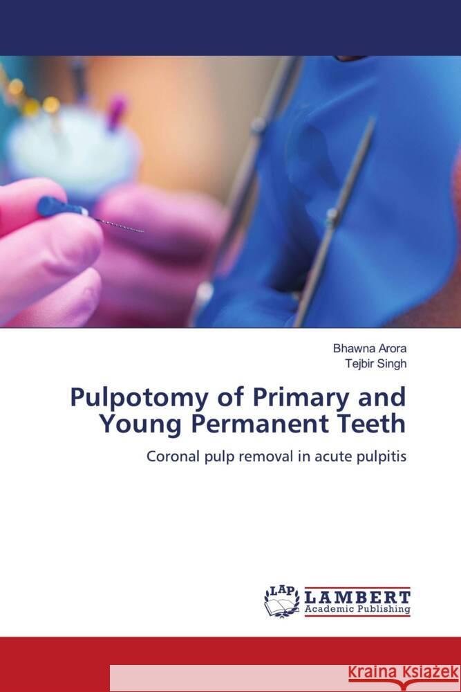 Pulpotomy of Primary and Young Permanent Teeth Bhawna Arora Tejbir Singh 9786207484553