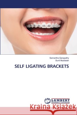 Self Ligating Brackets Samantha Ganapathy Sunil Muddaiah 9786207487745