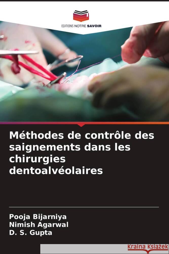 M?thodes de contr?le des saignements dans les chirurgies dentoalv?olaires Pooja Bijarniya Nimish Agarwal D. S. Gupta 9786207490219 Editions Notre Savoir