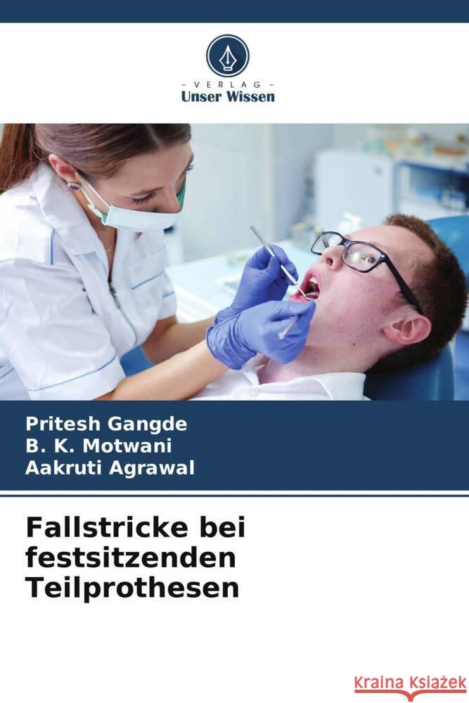 Fallstricke bei festsitzenden Teilprothesen Pritesh Gangde B. K. Motwani Aakruti Agrawal 9786207495276