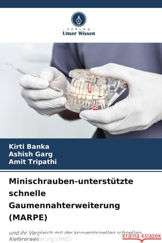 Minischrauben-unterst?tzte schnelle Gaumennahterweiterung (MARPE) Kirti Banka Ashish Garg Amit Tripathi 9786207502349 Verlag Unser Wissen