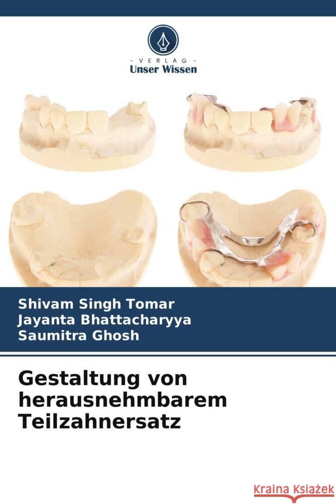 Gestaltung von herausnehmbarem Teilzahnersatz Shivam Singh Tomar Jayanta Bhattacharyya Saumitra Ghosh 9786207505456