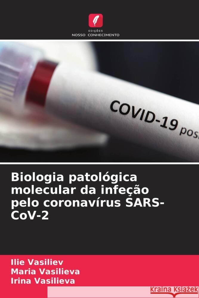 Biologia patol?gica molecular da infe??o pelo coronav?rus SARS-CoV-2 Ilie Vasiliev Maria Vasilieva Irina Vasilieva 9786207511136