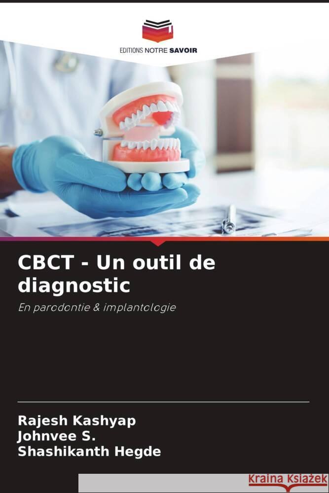 CBCT - Un outil de diagnostic Rajesh Kashyap Johnvee S Shashikanth Hegde 9786207512898