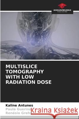 Multislice Tomography with Low Radiation Dose Kaline Antunes Paula Guerino Ren?sio Grehs 9786207516827