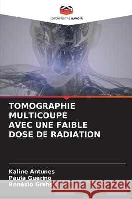 Tomographie Multicoupe Avec Une Faible Dose de Radiation Kaline Antunes Paula Guerino Ren?sio Grehs 9786207516841