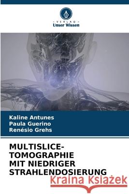 Multislice-Tomographie Mit Niedriger Strahlendosierung Kaline Antunes Paula Guerino Ren?sio Grehs 9786207516865