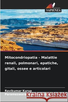 Mitocondriopatia - Malattie renali, polmonari, epatiche, gitali, ossee e articolari Ravikumar Kurup Parameswara Achuth 9786207522736 Edizioni Sapienza