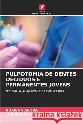 Pulpotomia de Dentes Dec?duos E Permanentes Jovens Bhawna Arora Tejbir Singh 9786207527953 Edicoes Nosso Conhecimento