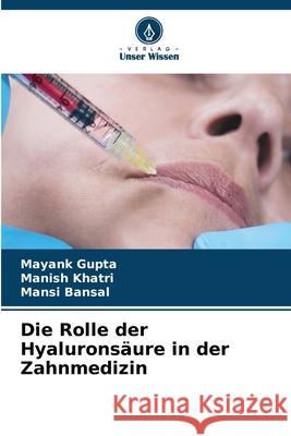 Die Rolle der Hyalurons?ure in der Zahnmedizin Mayank Gupta Manish Khatri Mansi Bansal 9786207531042 Verlag Unser Wissen