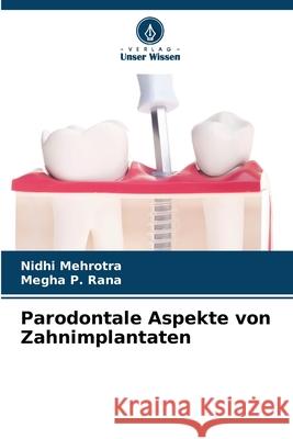 Parodontale Aspekte von Zahnimplantaten Nidhi Mehrotra Megha P 9786207544127 Verlag Unser Wissen