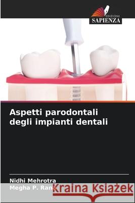 Aspetti parodontali degli impianti dentali Nidhi Mehrotra Megha P 9786207544141 Edizioni Sapienza