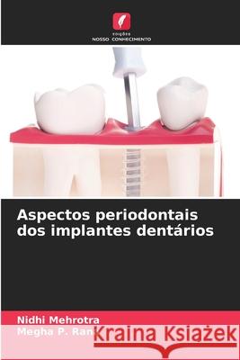 Aspectos periodontais dos implantes dent?rios Nidhi Mehrotra Megha P 9786207544158 Edicoes Nosso Conhecimento