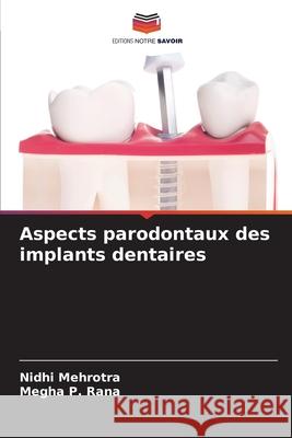 Aspects parodontaux des implants dentaires Nidhi Mehrotra Megha P 9786207544172 Editions Notre Savoir