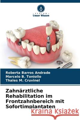 Zahn?rztliche Rehabilitation im Frontzahnbereich mit Sofortimplantaten Roberta Barros Andrade Marcelo B. Toniollo Thales M. Cruvinel 9786207546824