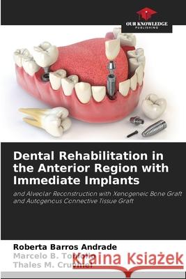 Dental Rehabilitation in the Anterior Region with Immediate Implants Roberta Barros Andrade Marcelo B. Toniollo Thales M. Cruvinel 9786207546831 Our Knowledge Publishing