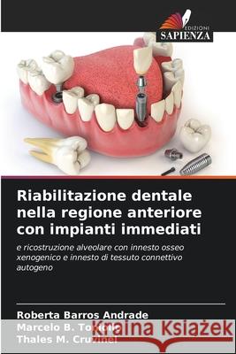 Riabilitazione dentale nella regione anteriore con impianti immediati Roberta Barros Andrade Marcelo B. Toniollo Thales M. Cruvinel 9786207546862