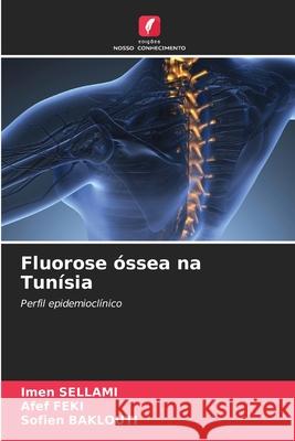 Fluorose ?ssea na Tun?sia Imen Sellami Afef Feki Sofien Baklouti 9786207546978