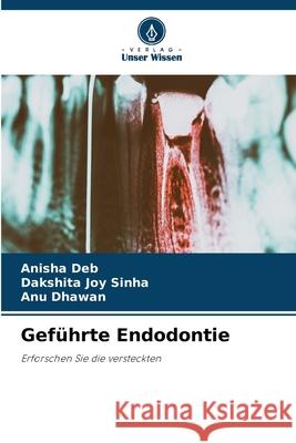 Gef?hrte Endodontie Anisha Deb Dakshita Joy Sinha Anu Dhawan 9786207547128