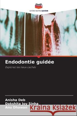 Endodontie guid?e Anisha Deb Dakshita Joy Sinha Anu Dhawan 9786207547135 Editions Notre Savoir