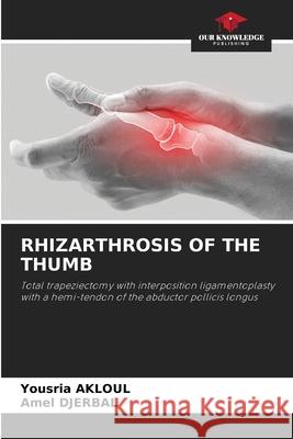 Rhizarthrosis of the Thumb Yousria Akloul Amel Djerbal 9786207556069