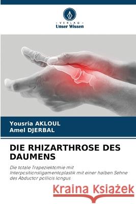 Die Rhizarthrose Des Daumens Yousria Akloul Amel Djerbal 9786207556076