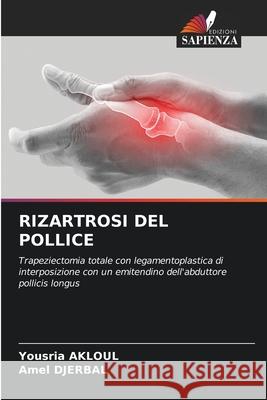 Rizartrosi del Pollice Yousria Akloul Amel Djerbal 9786207556113