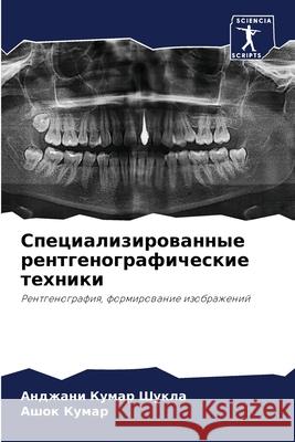 Специализированные рен&#  Шукла  Кумар 9786207560554 Sciencia Scripts