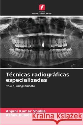 T?cnicas radiogr?ficas especializadas Anjani Kumar Shukla Ashok Kumar 9786207560561 Edicoes Nosso Conhecimento